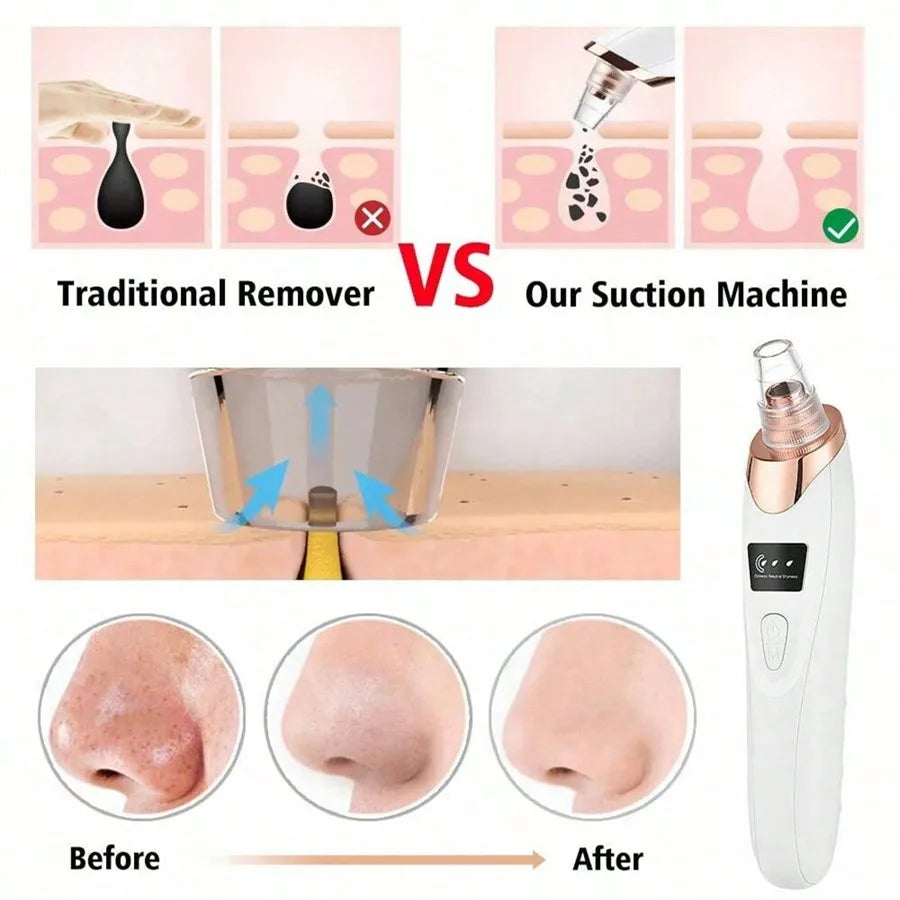 Limpador Facial a Vácuo